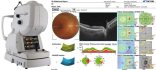 Optical Coherence Tomography Optical Coherence Tomography