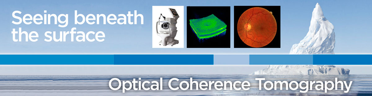 Optical Coherence Tomography Optical Coherence Tomography